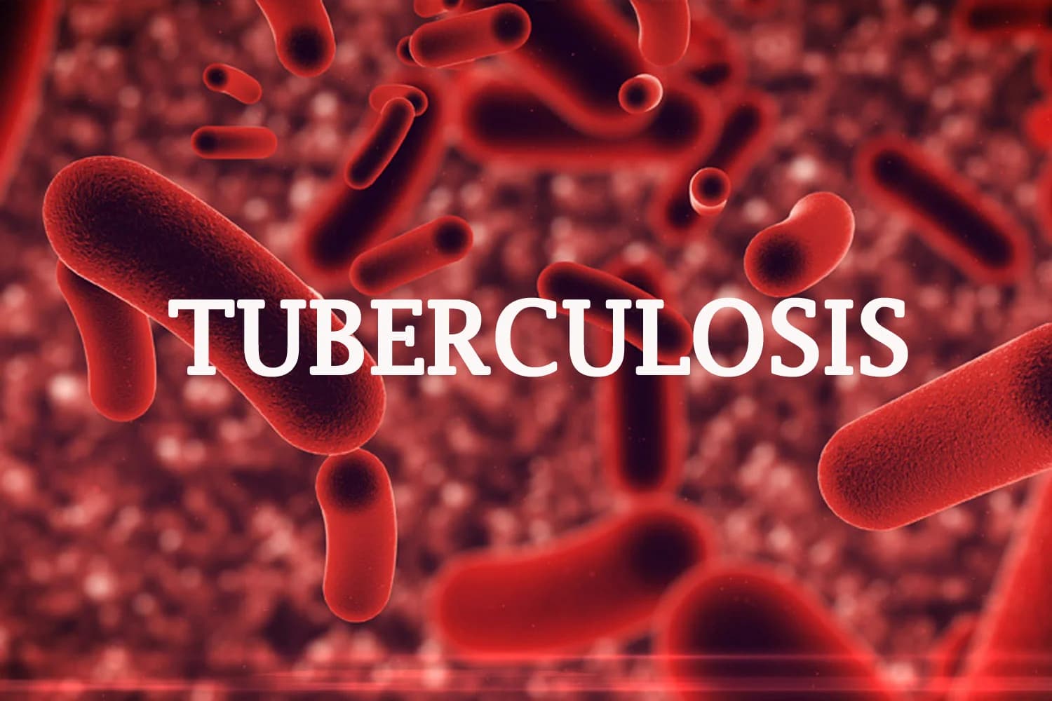 Nigeria’s TB response faces funding crisis – Coordinator
