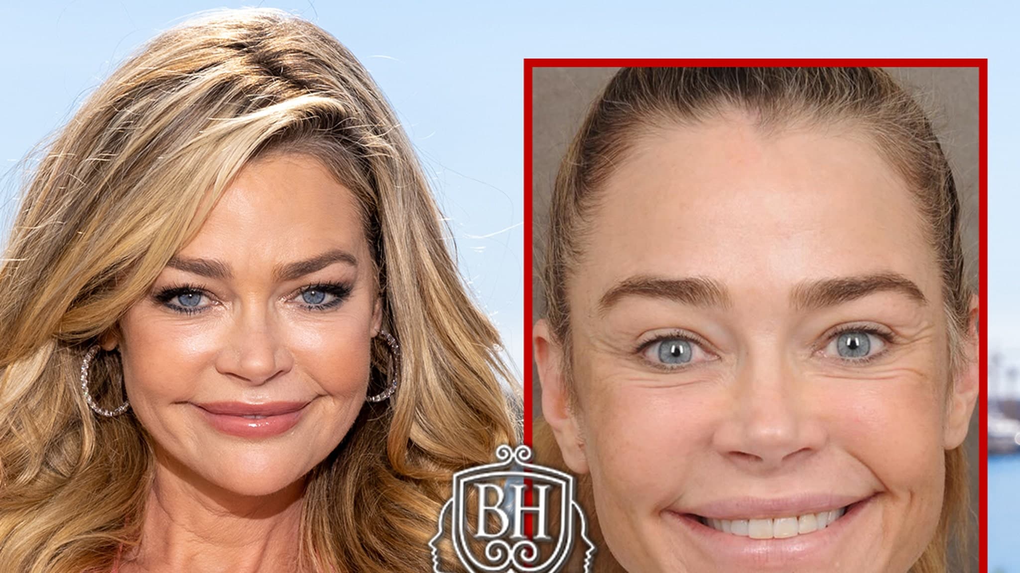 Denise Richards' Before-and-After Pics Are Giving Her Surgeon's Business a Lift