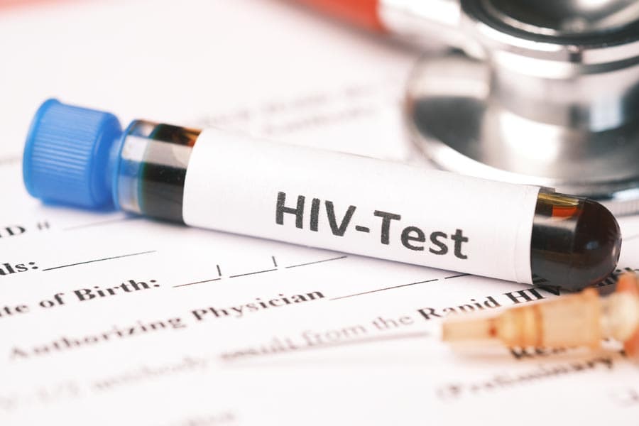 Eastern Idaho sees ‘concerning increase’ in HIV infections