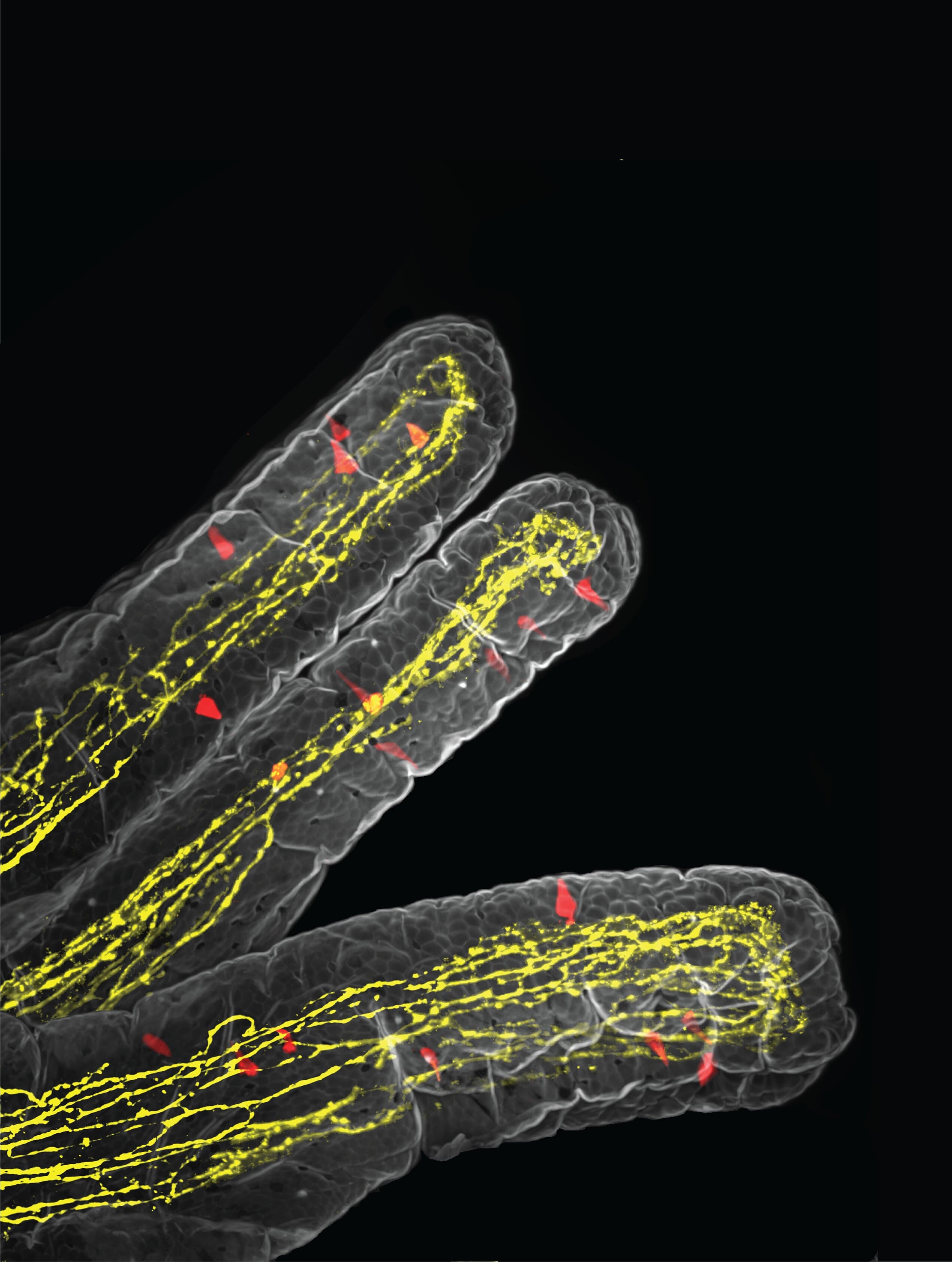Gut-to-brain pathway explains how the immune system triggers loss of appetite during parasitic infection