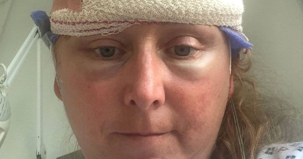 'I thought it was menopause before they found 10 tumours and I went blind in one eye'